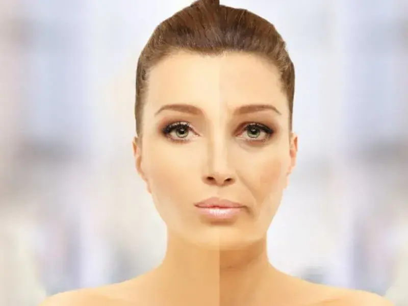 HALSSTRAFFUNG OHNE OP